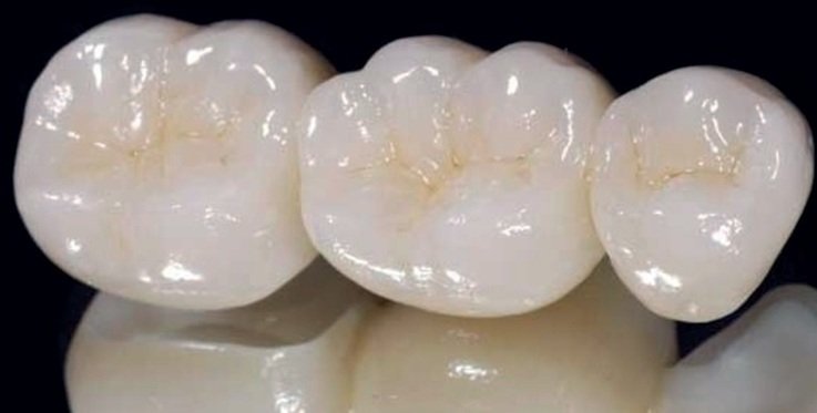 Restauraciones y prótesis